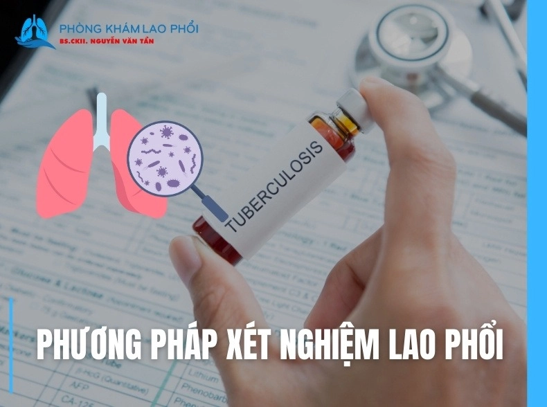 Xét nghiệm lao phổi: Quy trình, chi phí và kết quả