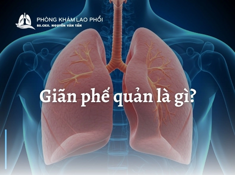 Giãn phế quản là gì? Nguyên nhân và cách điều trị