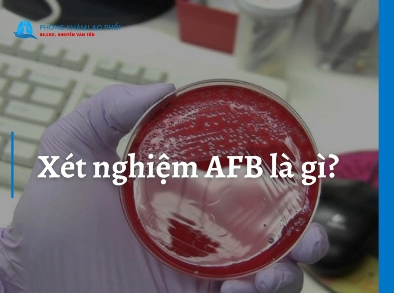 Xét nghiệm AFB là gì? Quy trình thực hiện và ý nghĩa kết quả