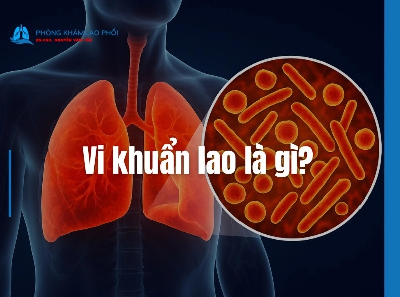 Vi khuẩn Lao là gì? Đặc điểm, nguy cơ lây nhiễm và cách chẩn đoán