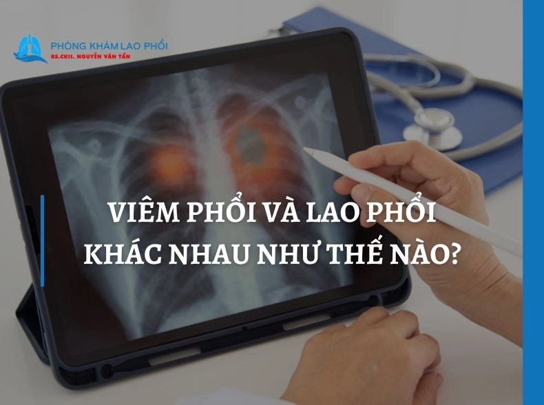 Viêm phổi và lao phổi khác nhau như thế nào? Dấu hiệu từng bệnh