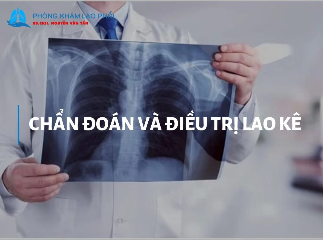 Chẩn đoán và điều trị lao kê