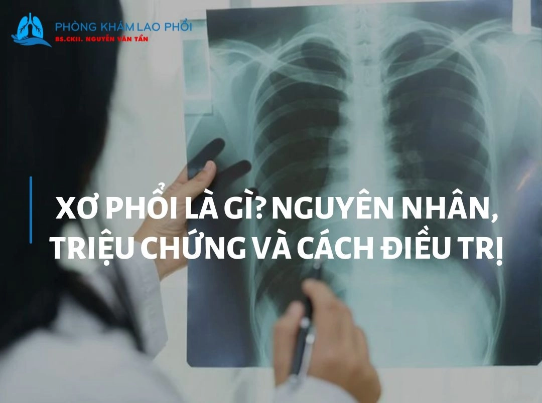 Xơ phổi là gì? Nguyên nhân, triệu chứng và cách điều trị