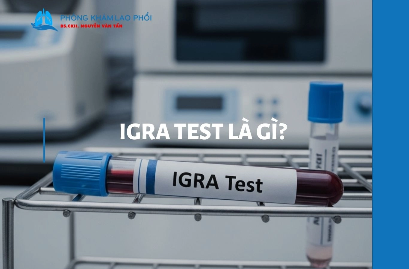 IGRA test là gì? Quy trình và đối tượng cần xét nghiệm