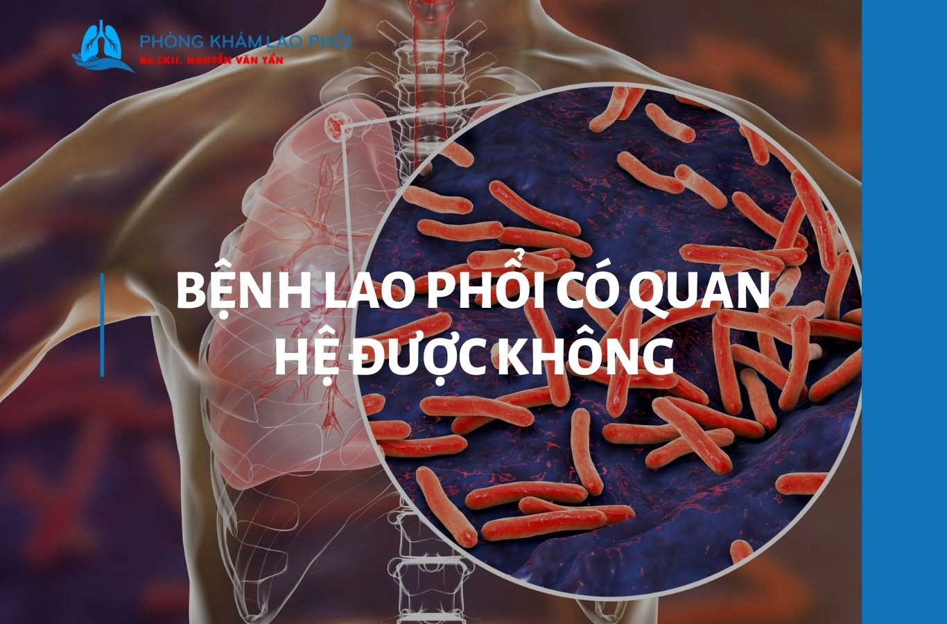 Bệnh lao phổi có quan hệ tình dục được không? Hướng dẫn an toàn từ chuyên gia