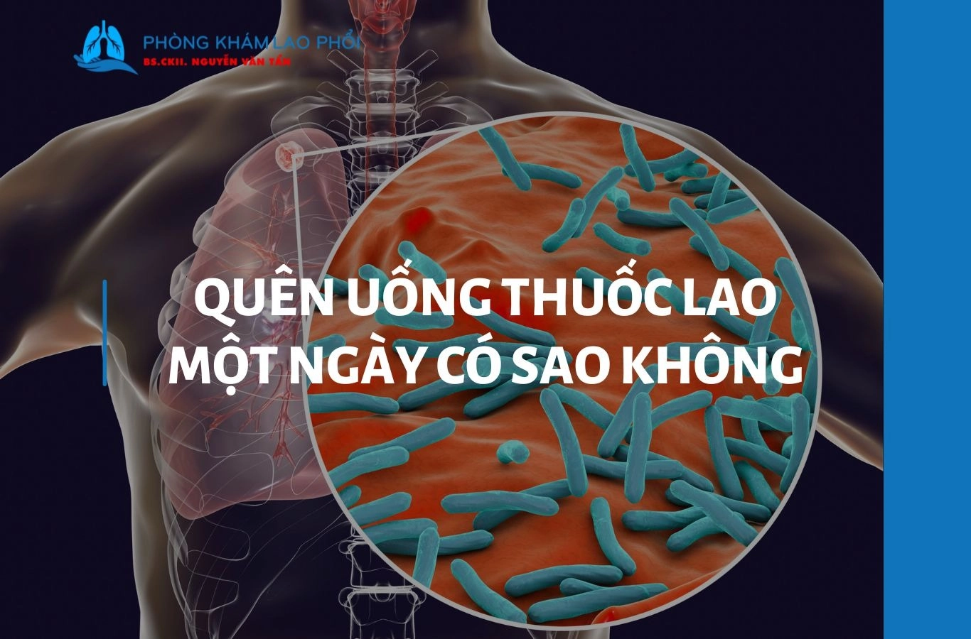 Quên uống thuốc lao 1 ngày có sao không? Cách xử lý an toàn