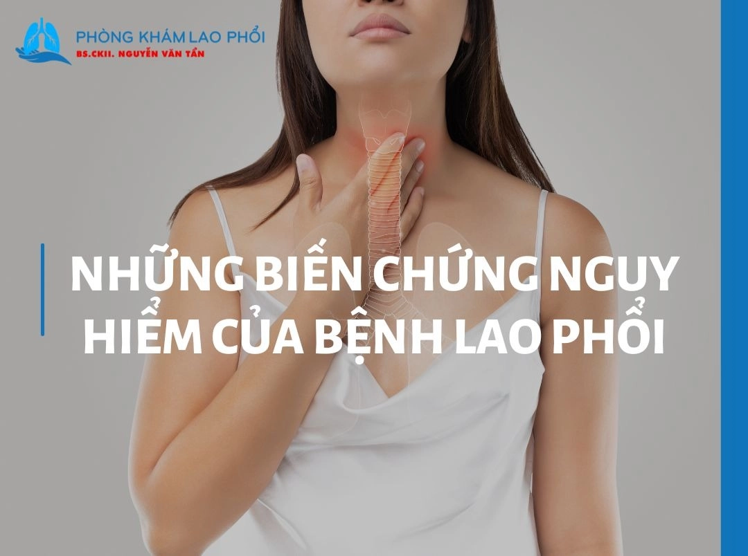 Những biến chứng nguy hiểm thường gặp ở bệnh lao phổi [2025]