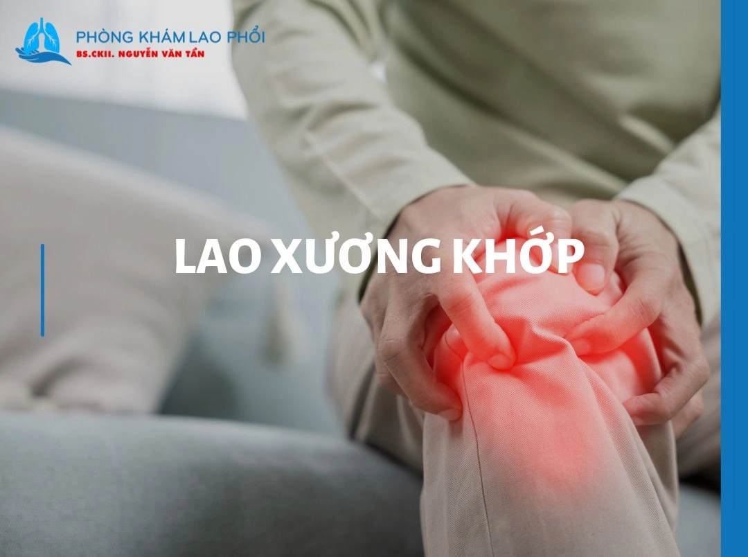 Lao xương khớp - Các triệu chứng và nguyên nhân cần biết