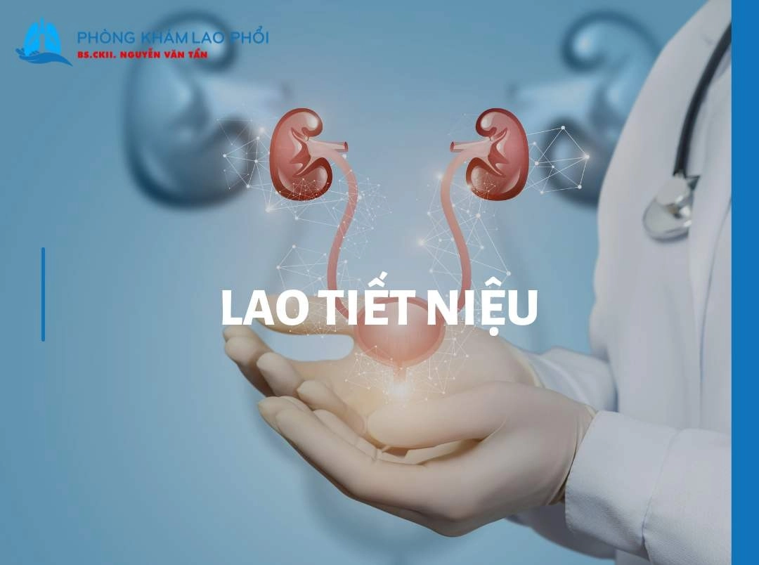 Bệnh lao tiết niệu có lây không? Ai dễ mắc và cách phòng tránh