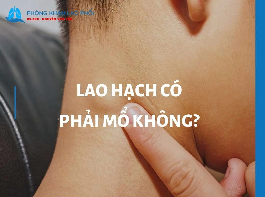 Bệnh lao hạch có phải mổ không? Các trường hợp bắt buộc và cách xử trí