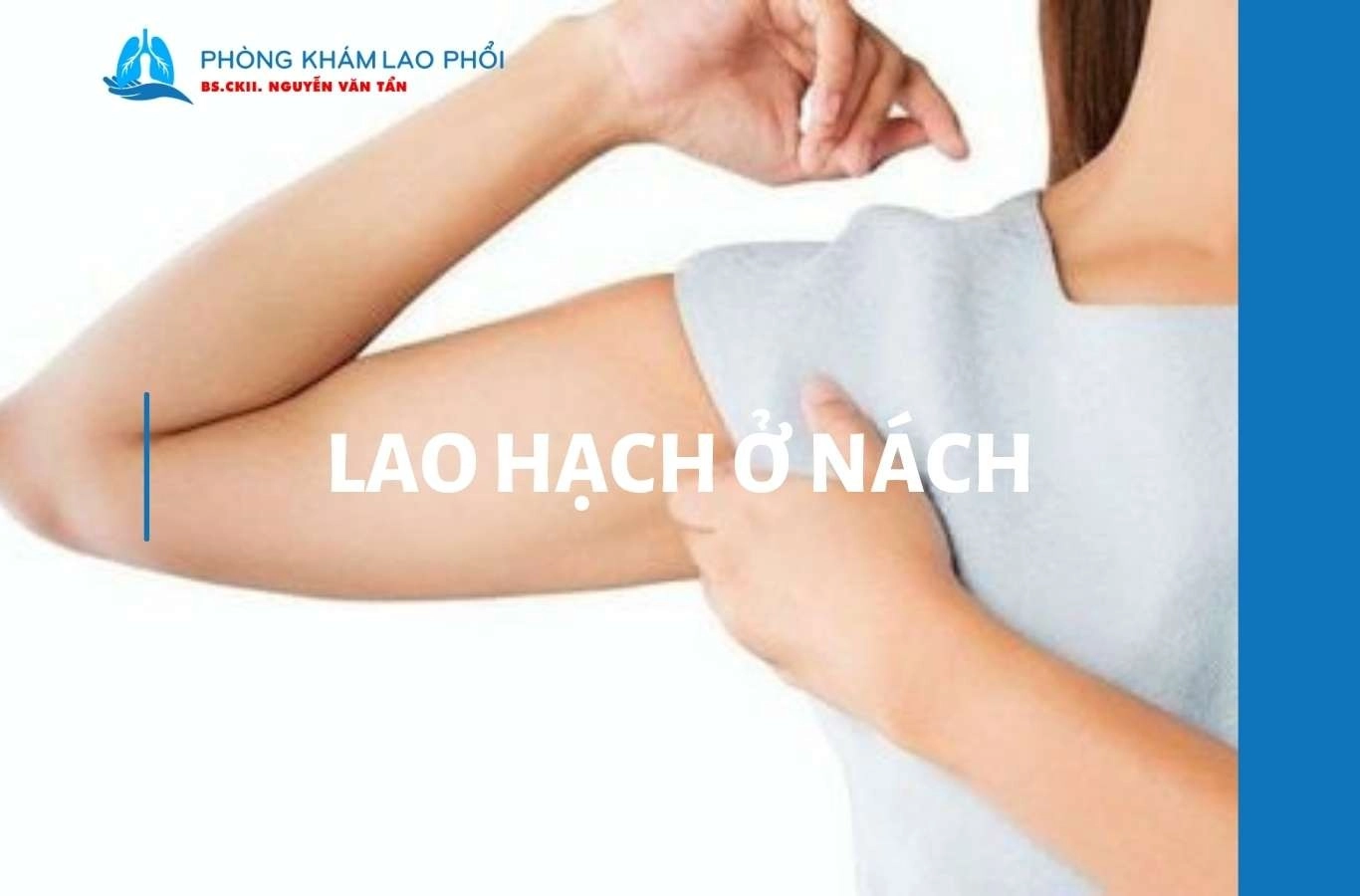 Lao hạch ở nách có nguy hiểm không và cách điều trị an toàn