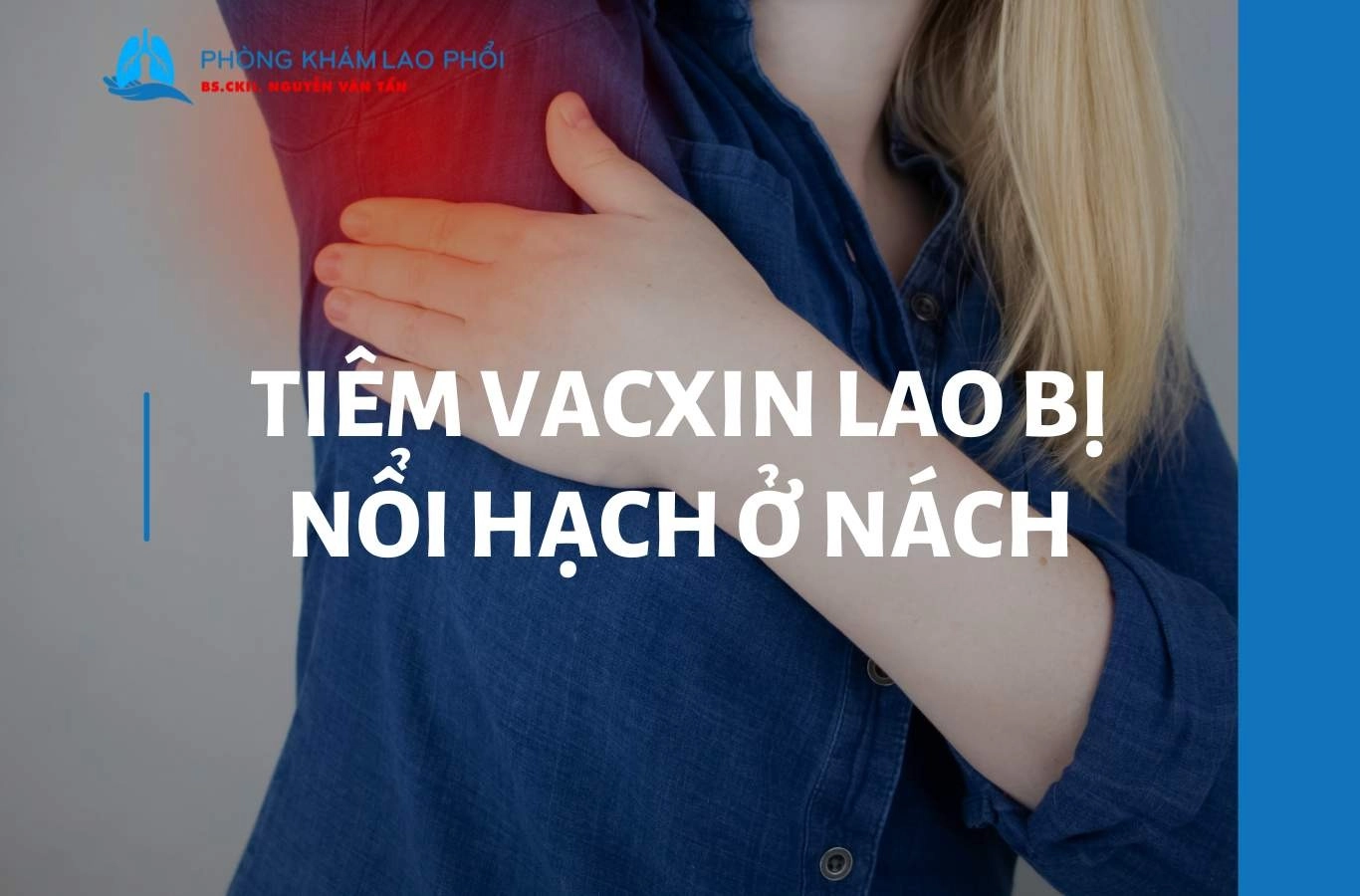 Tiêm vacxin lao bị nổi hạch ở nách có nguy hiểm không? Cách xử lý 
