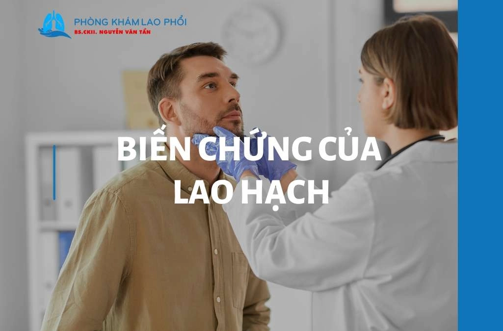6 biến chứng lao hạch thường gặp và hướng khắc phục [2025]