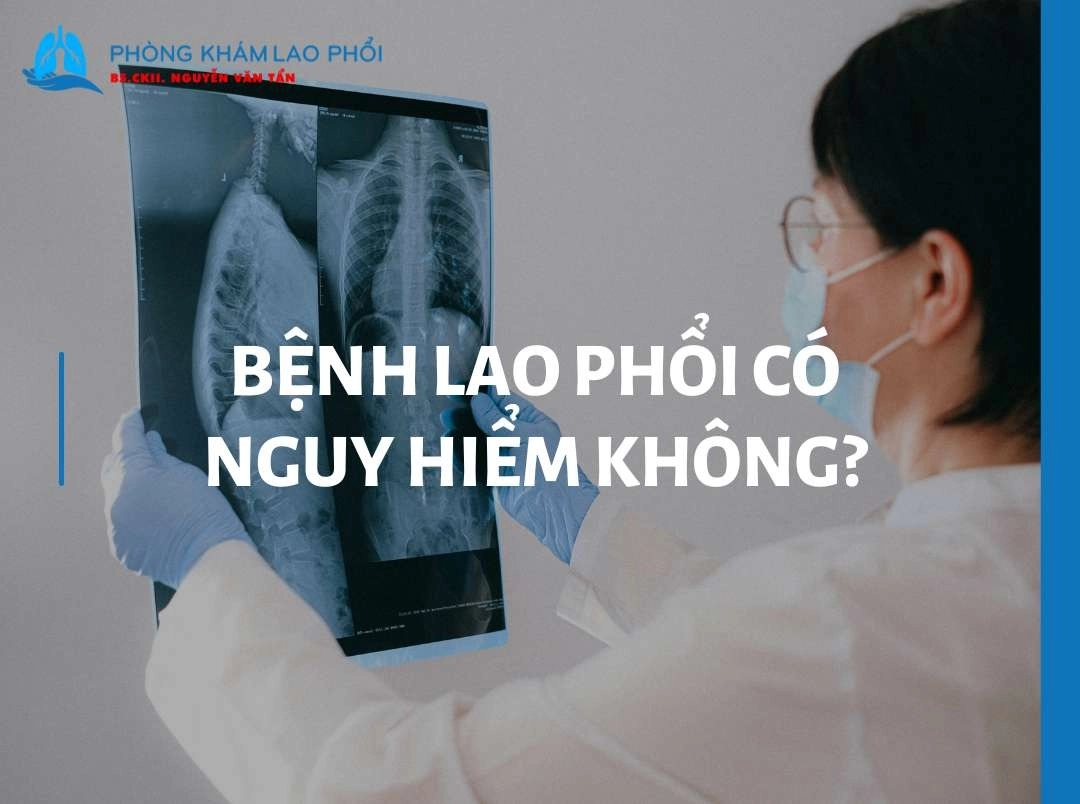 Bệnh lao phổi có nguy hiểm không?  Độ nghiêm trọng và biến chứng