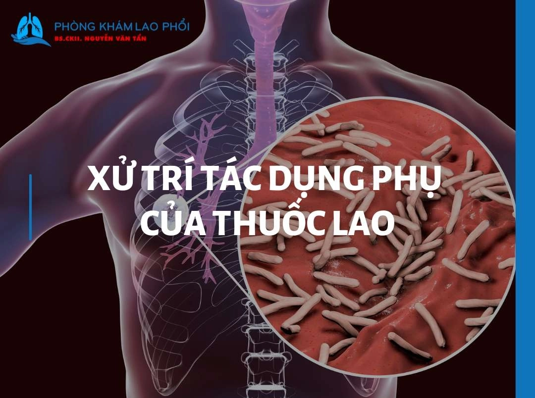 Một số tác dụng phụ của các thuốc điều trị bệnh lao phổi mới nhất
