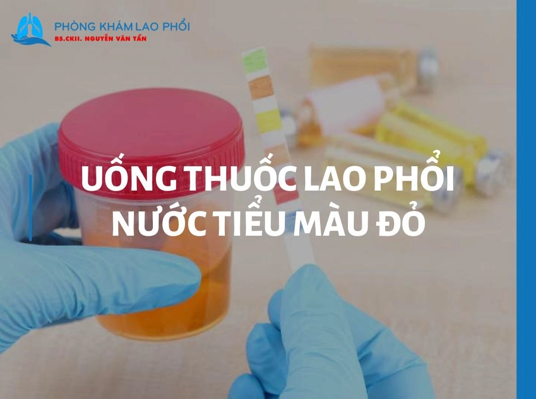 Uống thuốc lao phổi nước tiểu màu đỏ có phải dấu hiệu nguy hiểm?