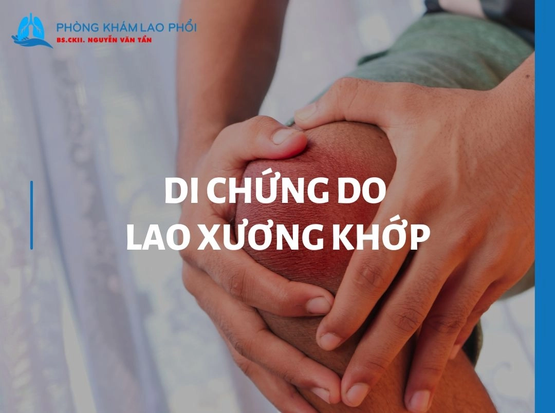 Di chứng do lao xương khớp - Biến dạng, teo cơ và giới hạn vận động