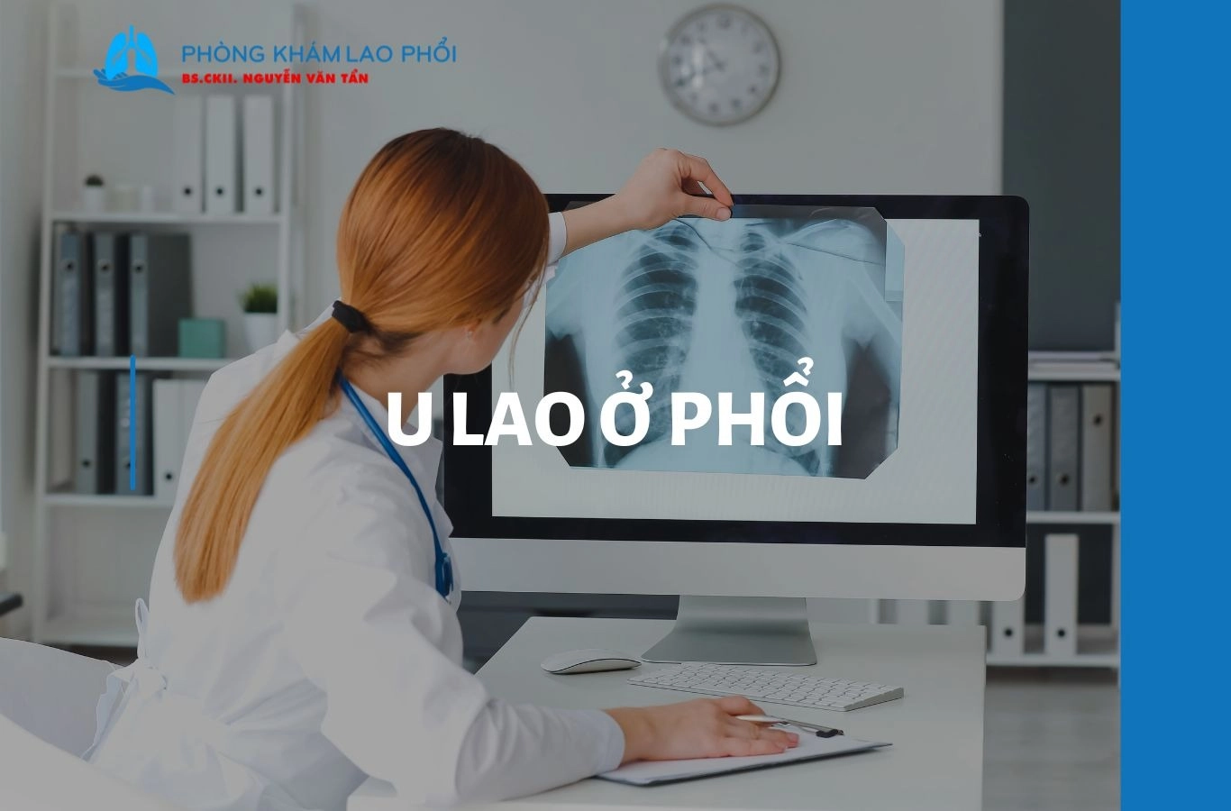 U lao ở phổi là gì? Triệu chứng và phương pháp điều trị