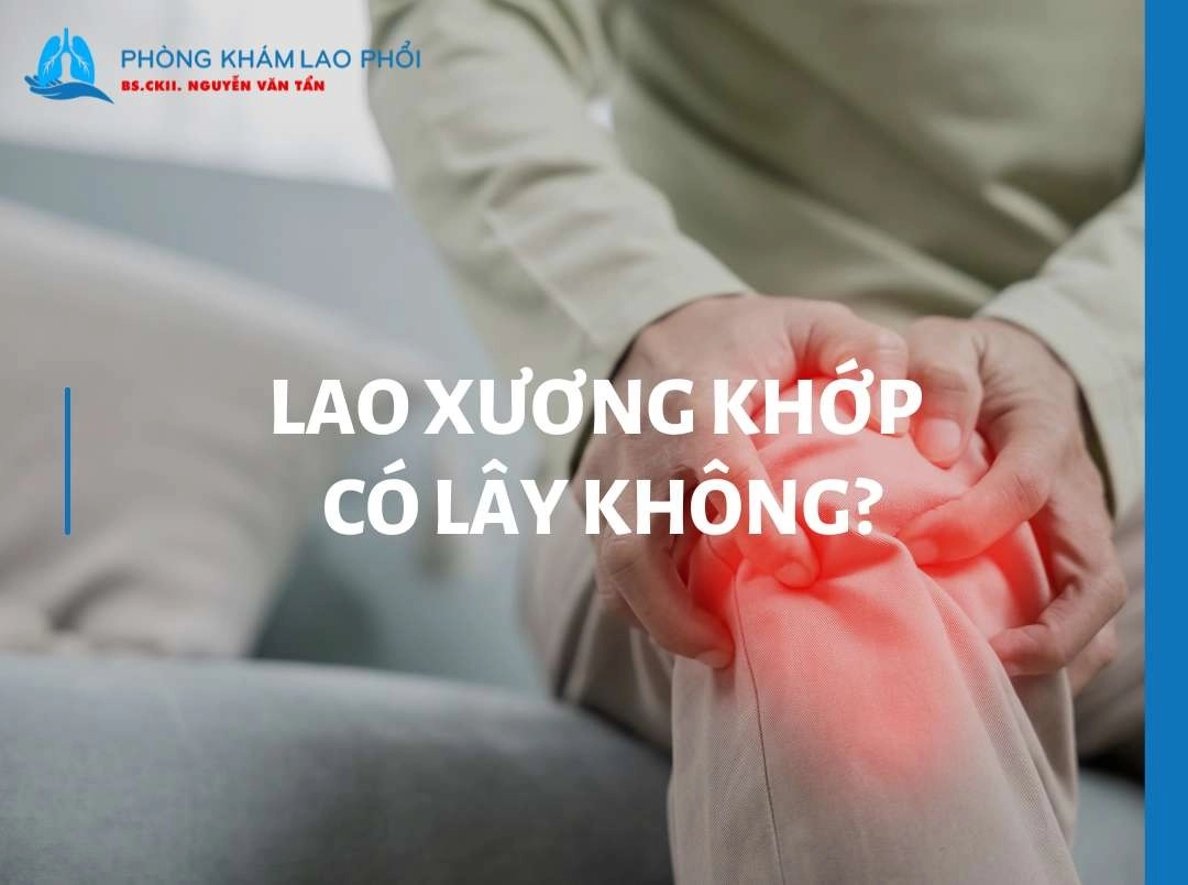 Lao xương khớp có lây không? Nguyên nhân và cách phòng ngừa