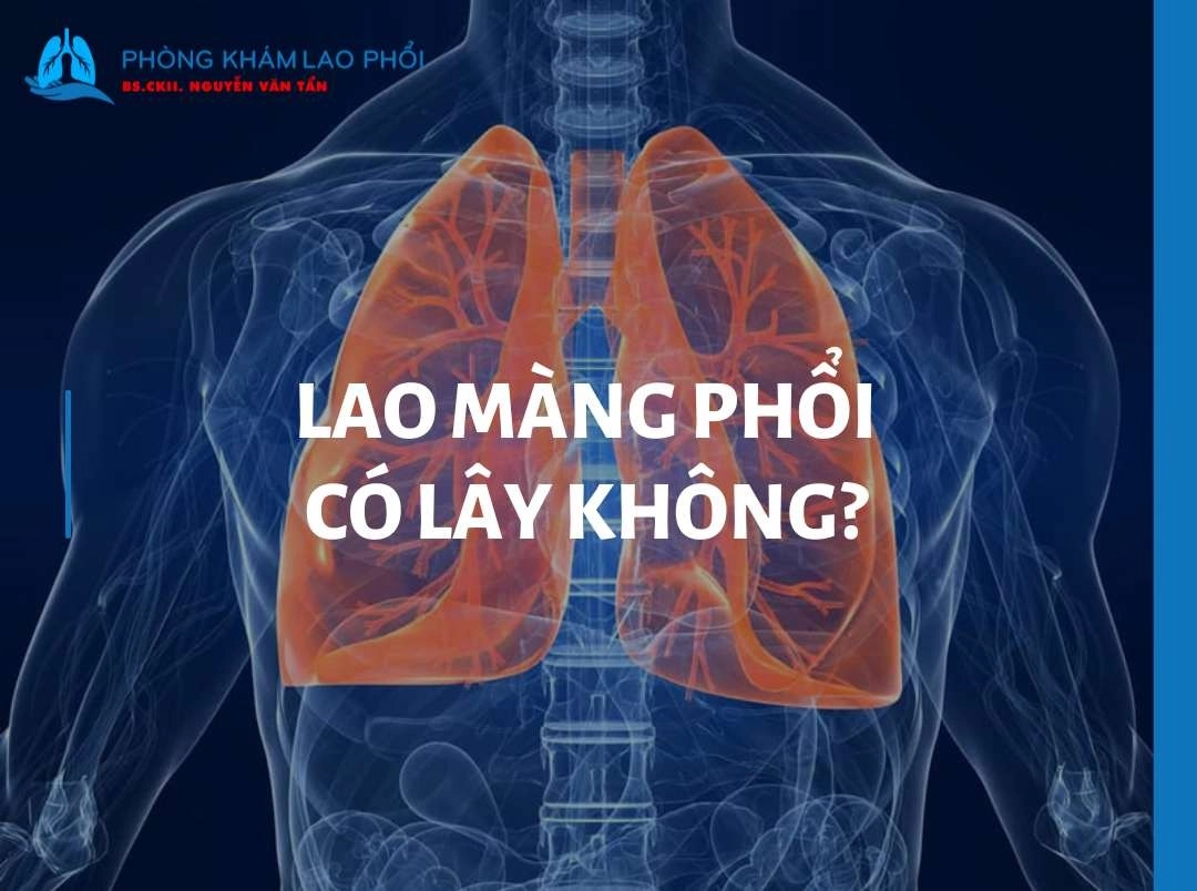 Lao màng phổi có lây không? Cách nhận biết và phòng tránh