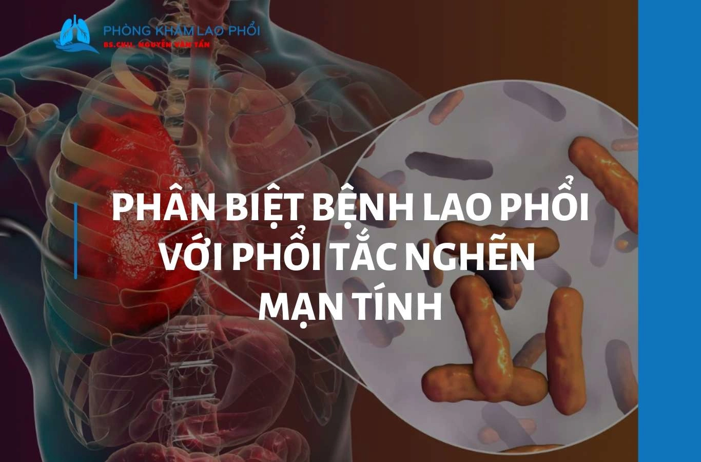 Phân biệt bệnh lao phổi với phổi tắc nghẽn mạn tính (COPD) 