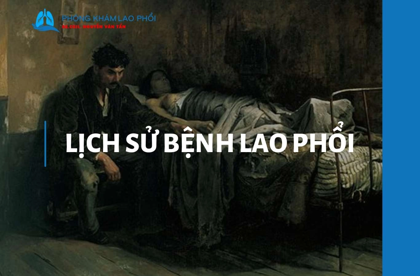Tìm hiểu lịch sử bệnh lao phổi và tác động xã hội của căn bệnh