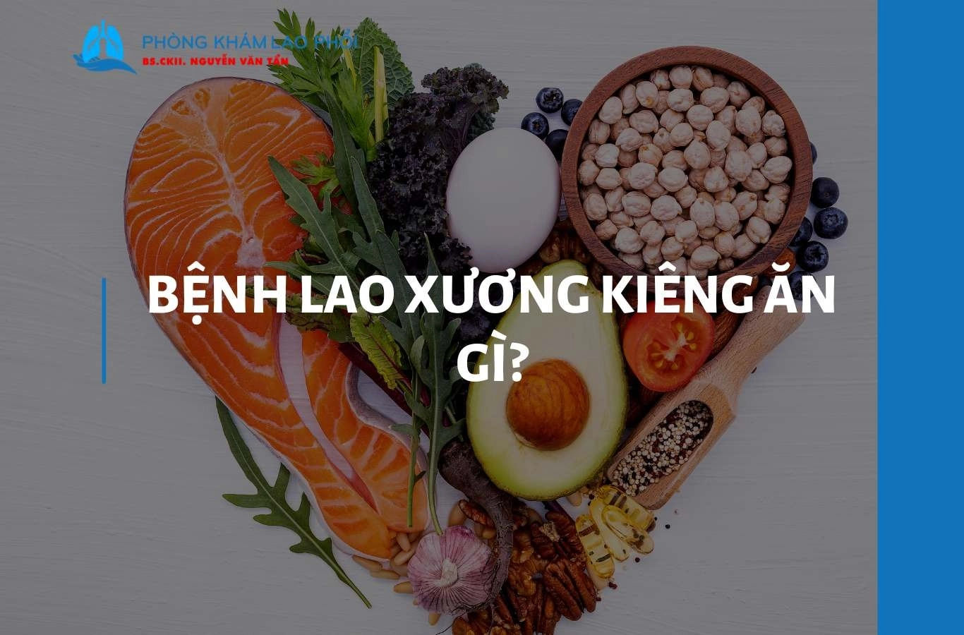 Bệnh lao xương kiêng ăn gì? Lưu ý dinh dưỡng người bệnh cần biết