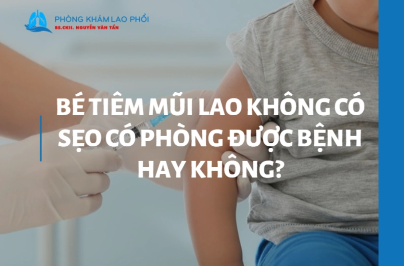 Bé tiêm mũi lao không có sẹo có phòng được bệnh hay không?