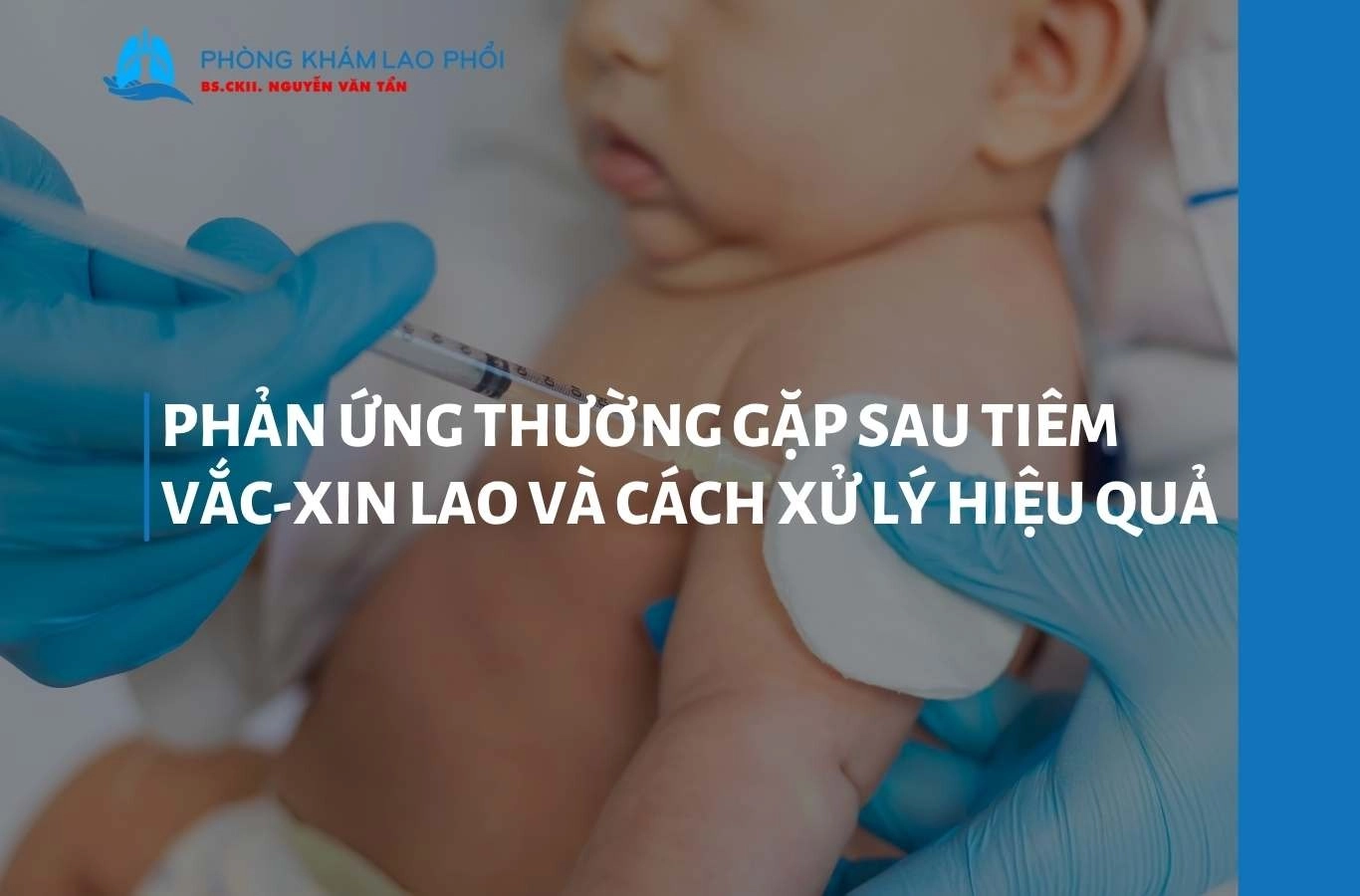 Phản ứng thường gặp sau tiêm vắc-xin lao và cách xử lý hiệu quả