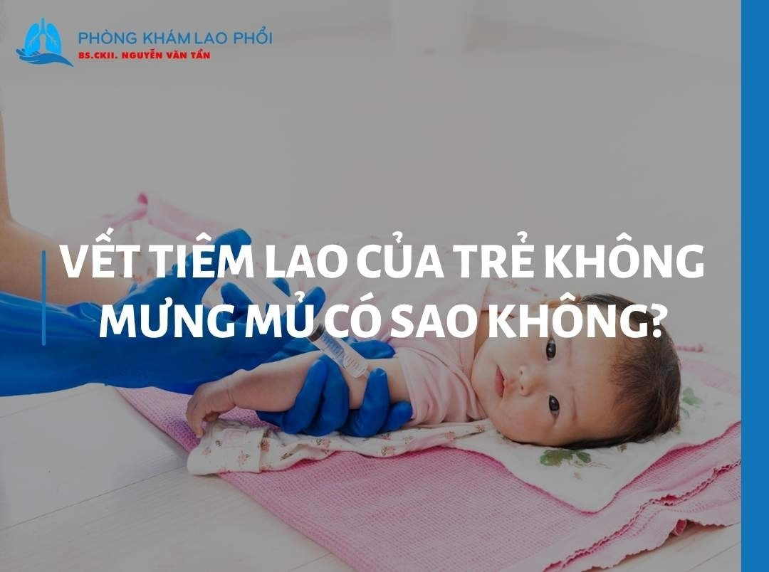 Vết tiêm lao của trẻ không mưng mủ có sao không? Khi nào cần khám?