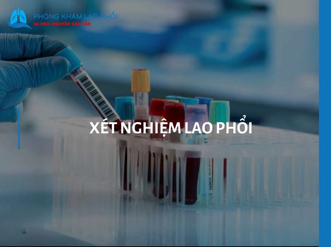 Các phương pháp xét nghiệm lao phổi phổ biến và chi phí mới nhất