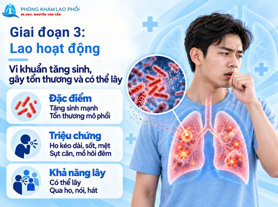 Lao phổi hoạt động có khả năng lây từ người sang người