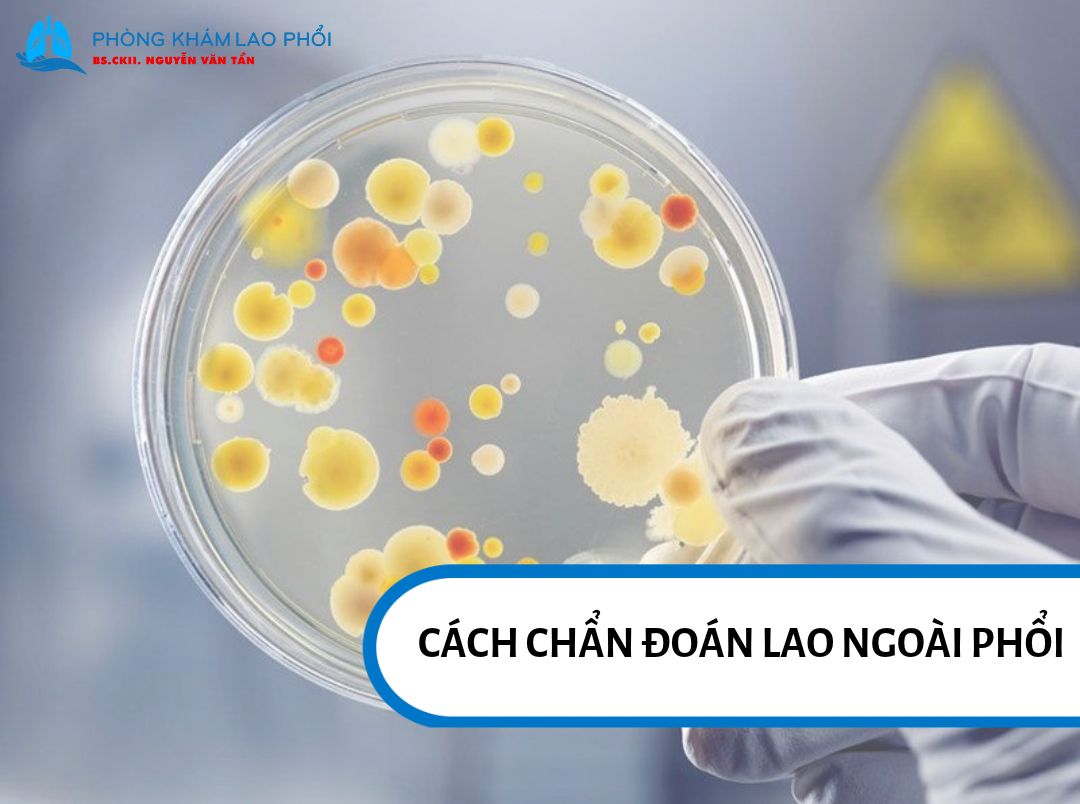 Xét nghiệm vi khuẩn học và sinh học phân tử để tìm vi khuẩn lao
