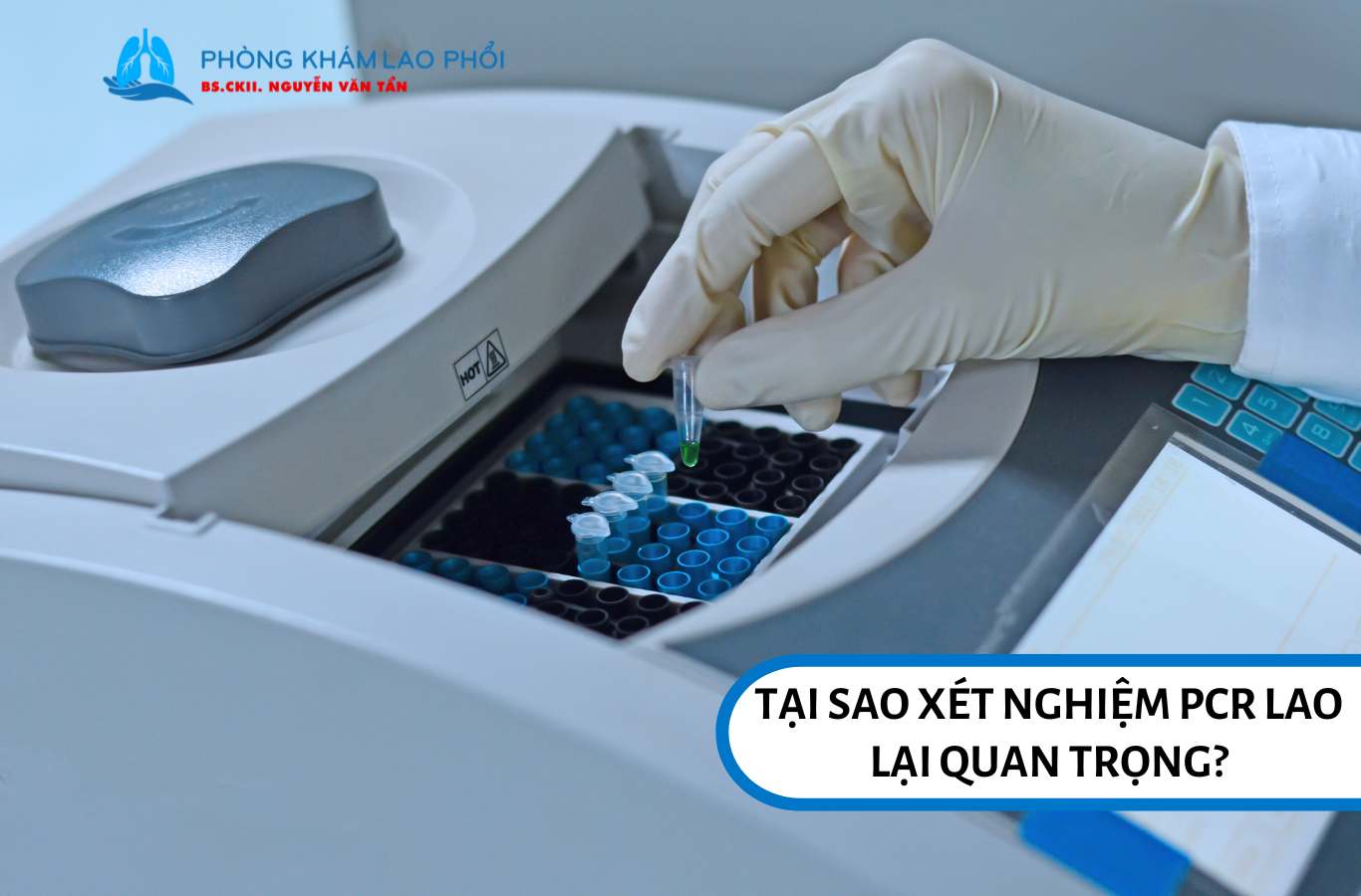 Xét nghiệm PCR lao giúp phát hiện lao kháng thuốc rifampin (RIF)