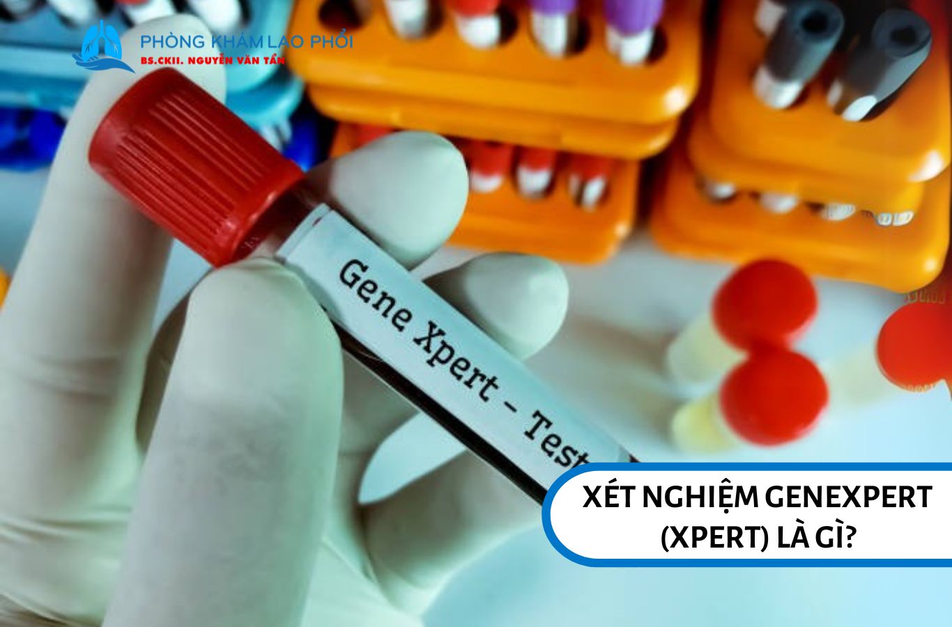 Xét nghiệm GeneXpert (Xpert)