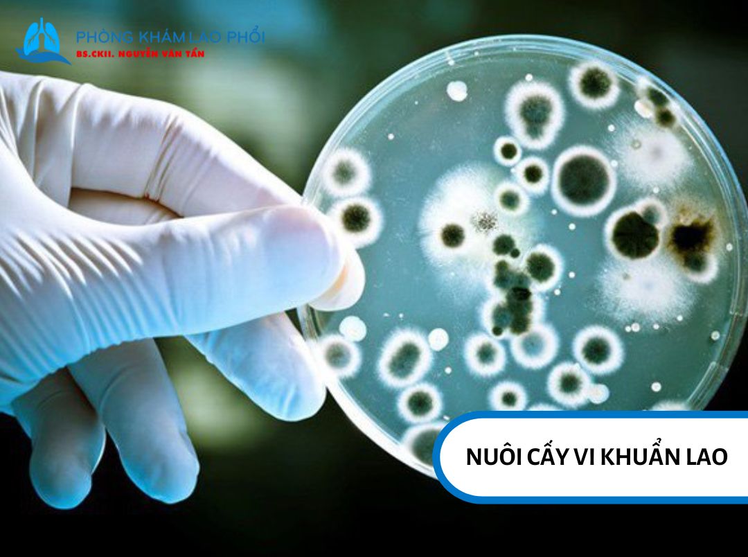 Xét nghiệm xác định lao kháng thuốc
