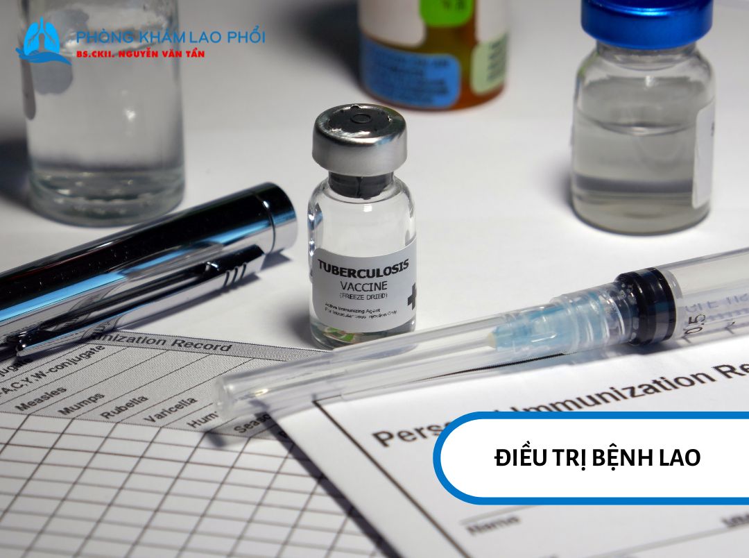Những lưu ý khi điều trị bệnh lao