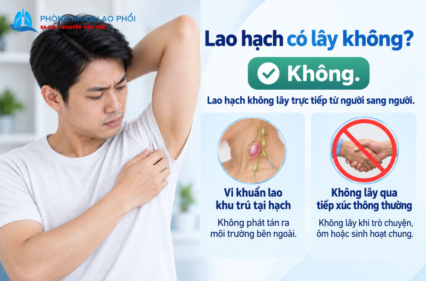 Lao hạch đơn thuần thường không lây qua tiếp xúc và sinh hoạt thông thường