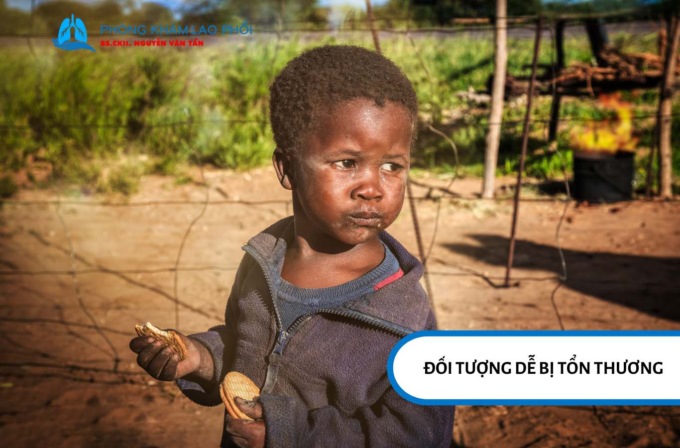 Trẻ em nghèo là những đối tượng dễ có nguy cơ tử vong nếu mắc lao phổi