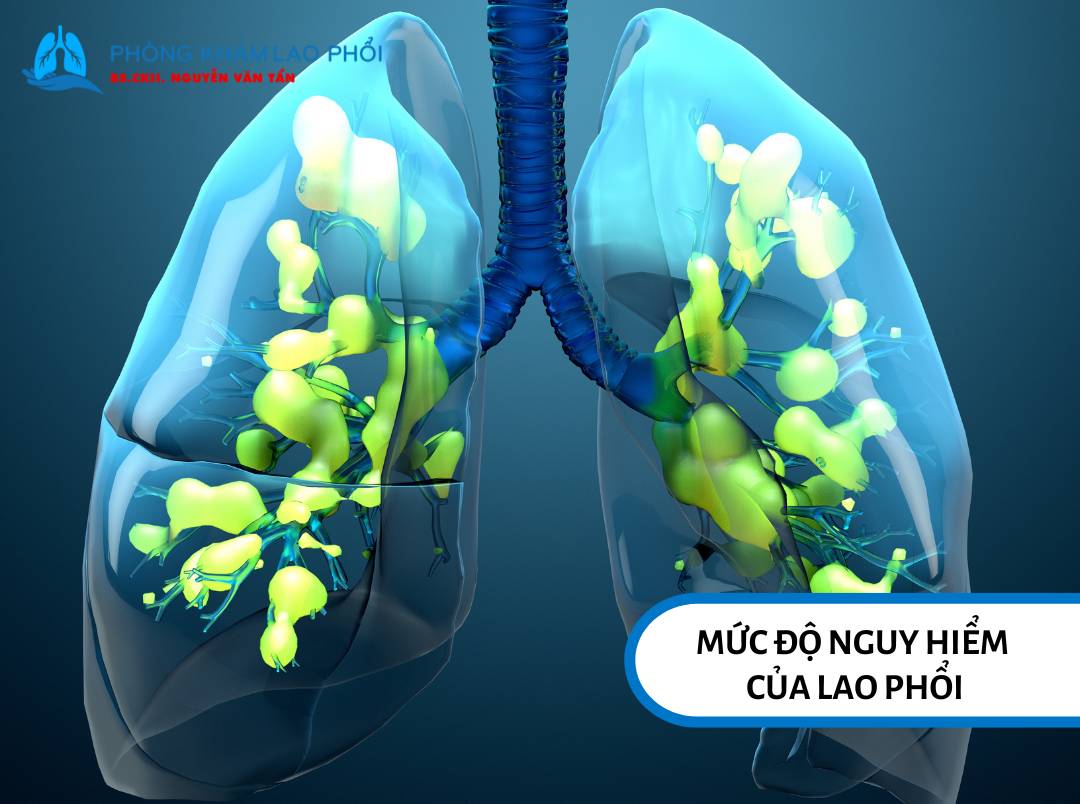 Bệnh lao phổi có thể trở nên vô cùng nguy hiểm khi không được phát hiện sớm