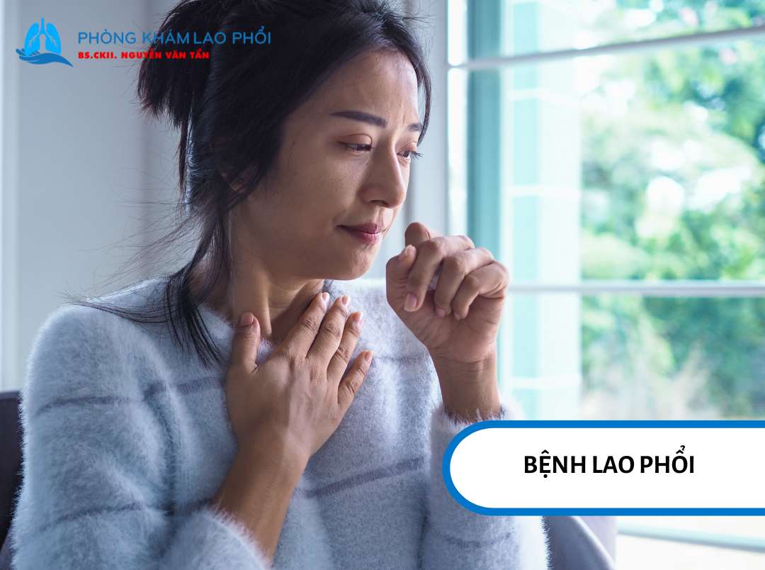 Tổng quan về bệnh lao