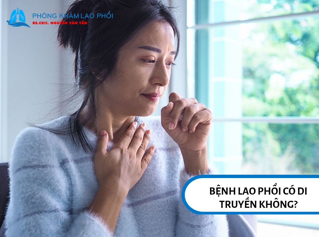 Lao phổi là bệnh truyền nhiễm do vi khuẩn Mycobacterium tuberculosis gây ra
