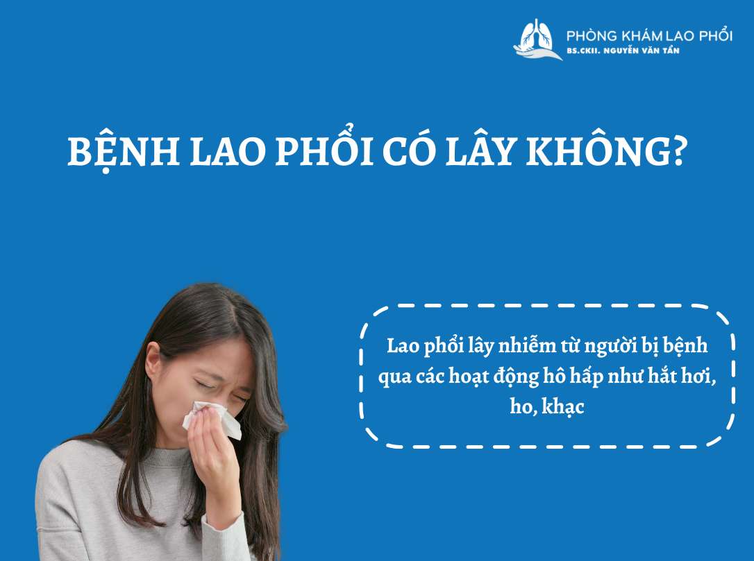 Bệnh lao phổi rất dễ lây qua đường hô hấp từ người bệnh