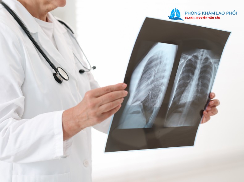 Bạn nên chú ý đến các triệu chứng của bệnh và thăm khám tại các cơ sở y tế để kiểm tra chính xác