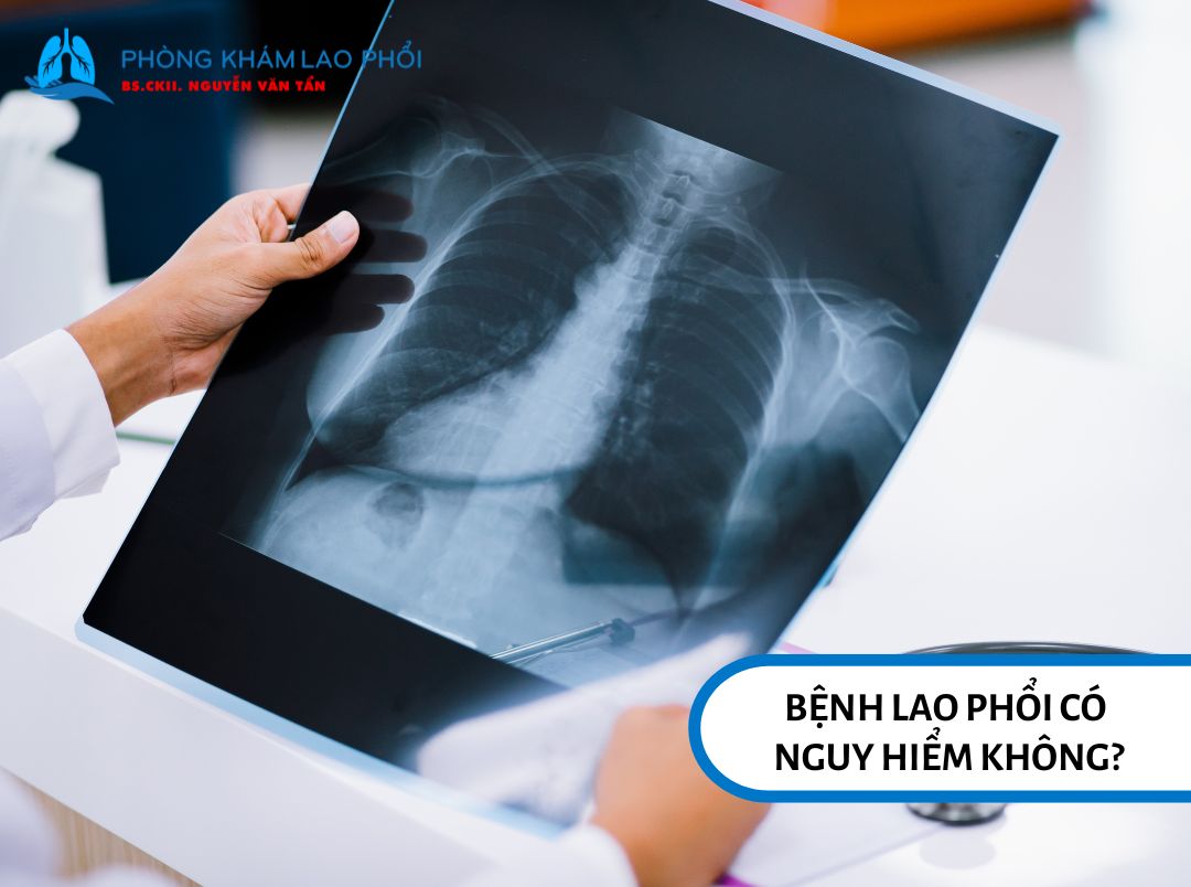 Bệnh lao phổi là căn bệnh nguy hiểm nếu không được phát hiện sớm và điều trị kịp thời