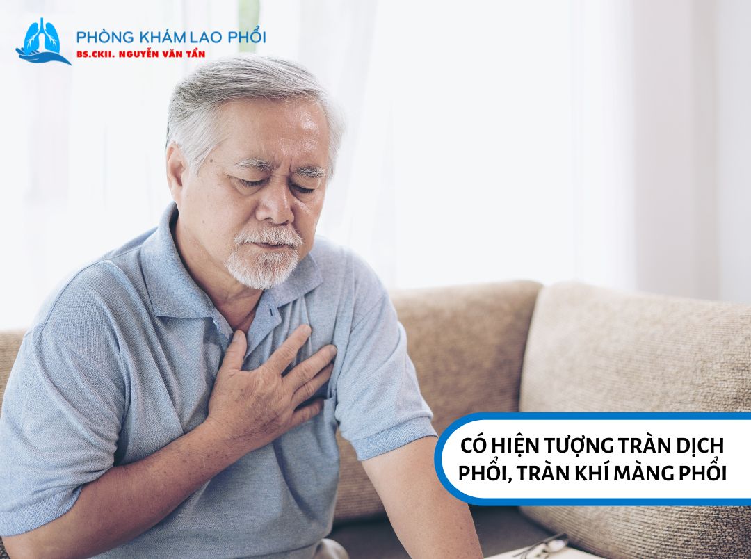 Có hiện tượng tràn dịch phổi, tràn khí màng phổi
