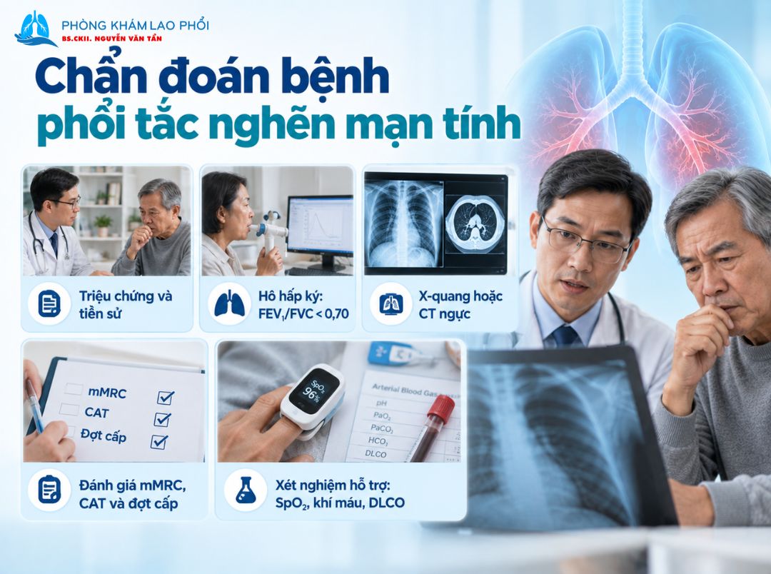 Hô hấp ký giúp đánh giá tình trạng tắc nghẽn đường thở