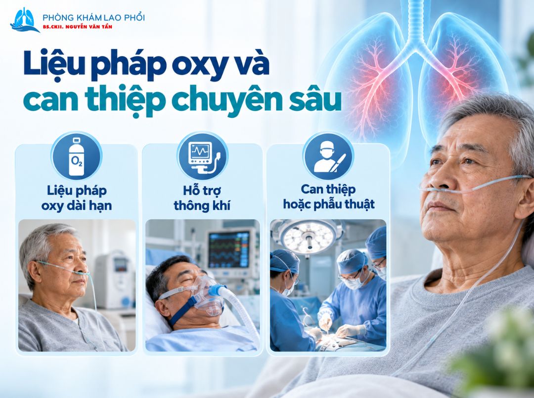Oxy hỗ trợ hô hấp cho người bệnh phổi tắc nghẽn mạn tính nặng