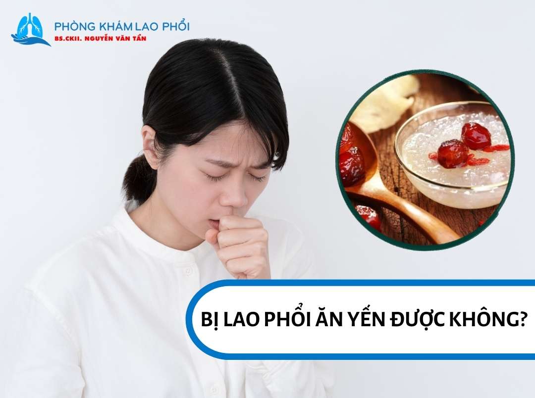 Người bị lao phổi vẫn có thể ăn tổ yến, vì đây là thực phẩm giàu dinh dưỡng có thể giúp bồi bổ cơ thể