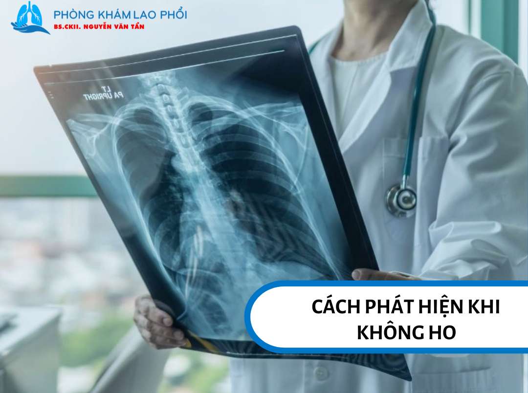 Chụp X-quang phổi giúp loại trừ lao hoạt động, không dùng để chẩn đoán lao tiềm ẩn